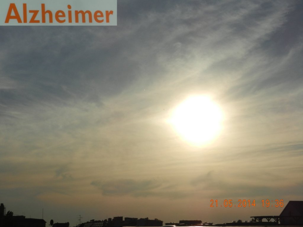 140521-110-alzheimer