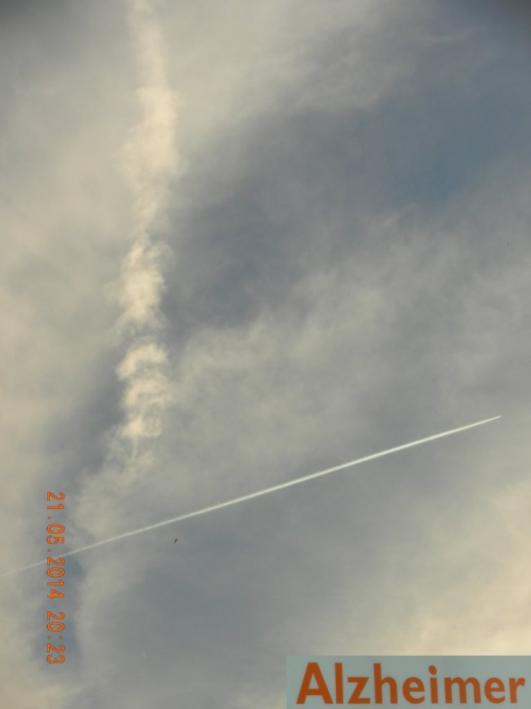 140521-138-alzheimer